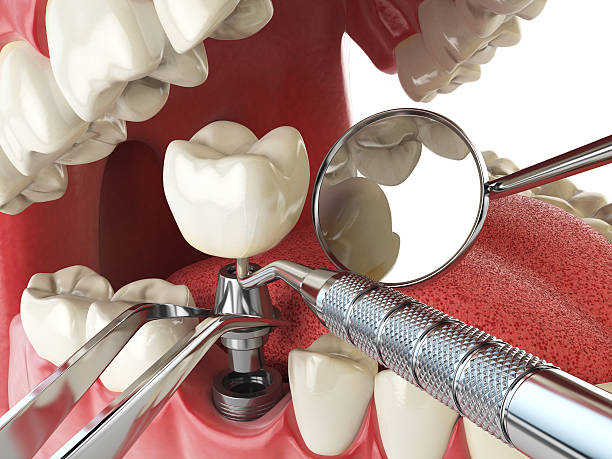 Best Emergency Dental Care for Trauma or Injury in Upland, IN