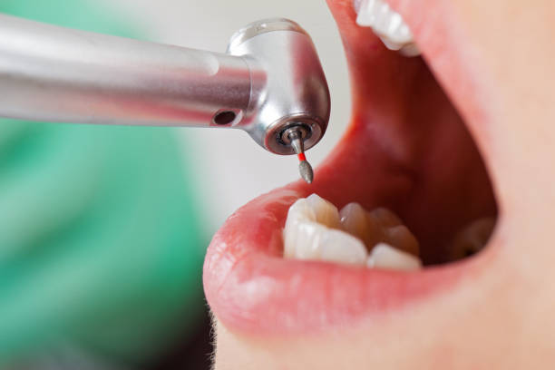 Best Pediatric Emergency Dentist in Upland, IN